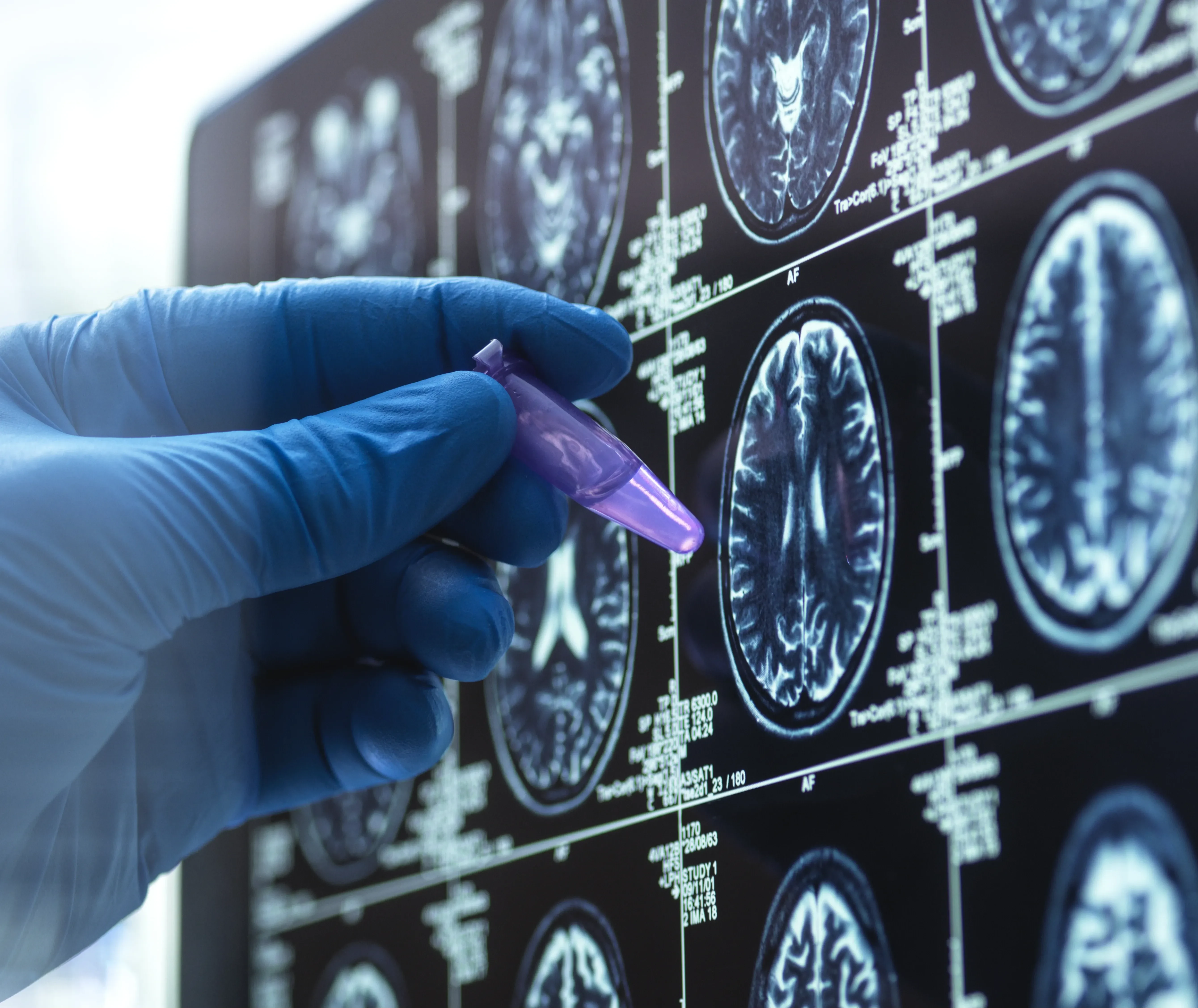 Diagnóstico por Imagen 